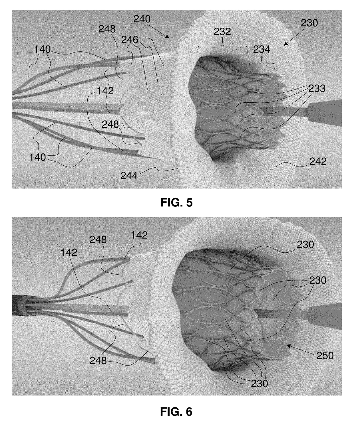 Actively controllable heart valve implant and method of controlling same