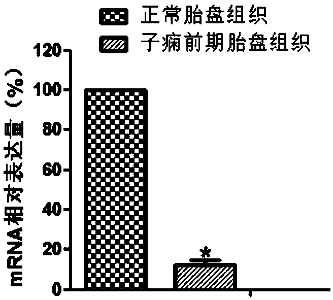 Marker of preeclampsia on gene level