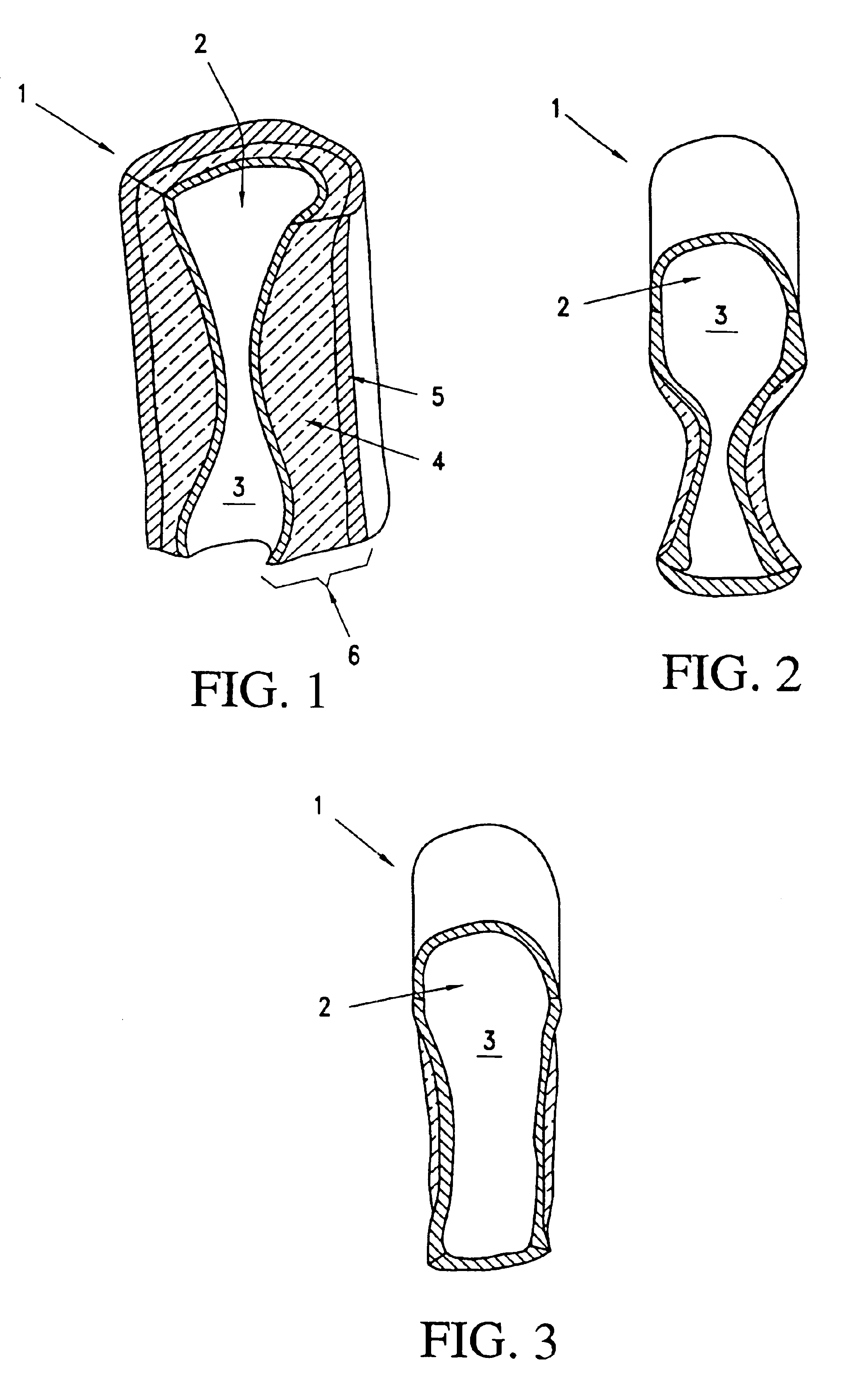 Apparatus for exterior arterial ablation