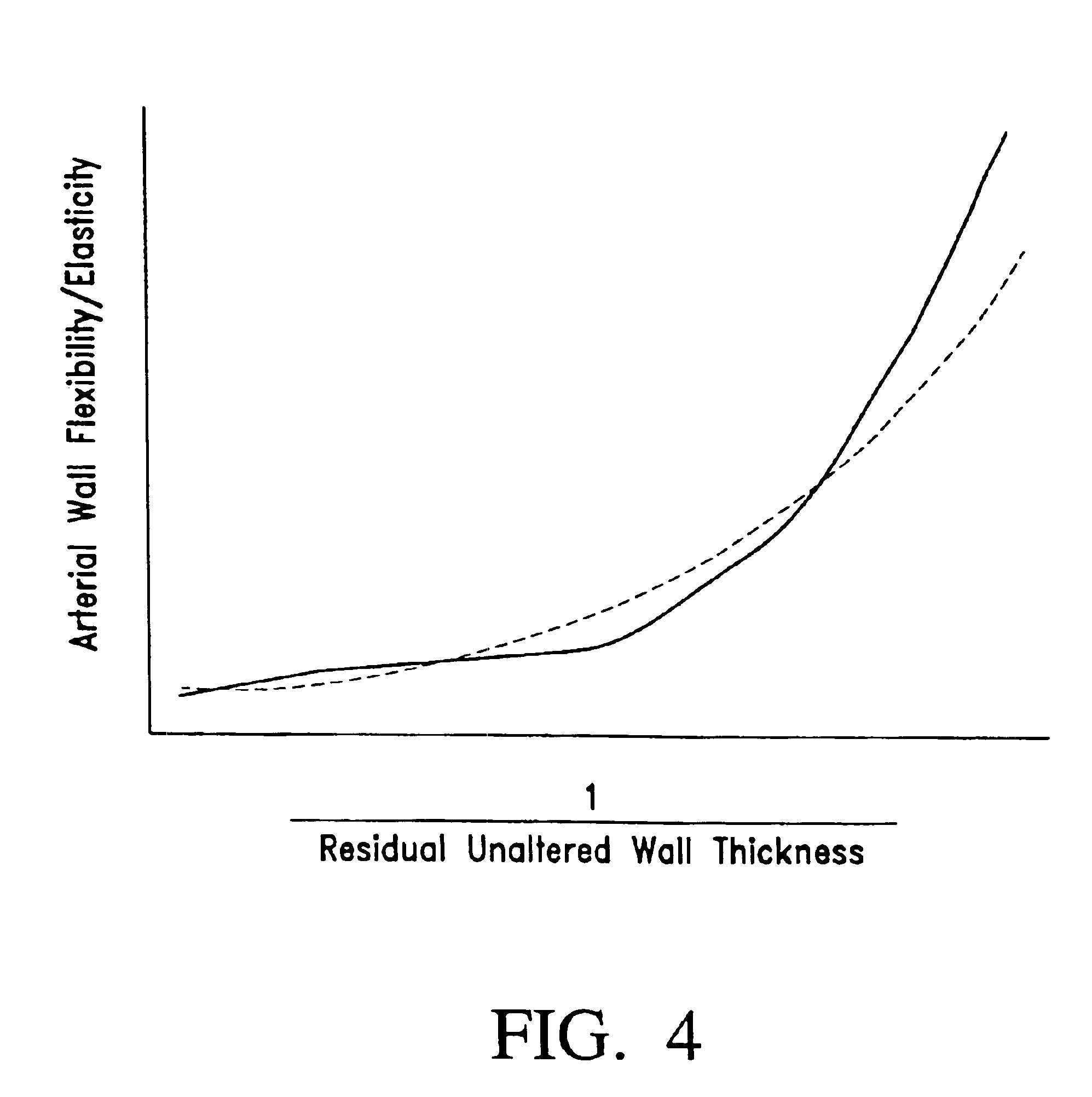 Apparatus for exterior arterial ablation