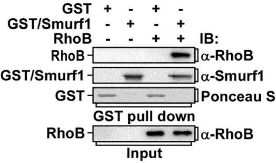 Antitumor drug screening method using RhoB inhibiting ubiquitination degradation of Smurf1 as therapeutic target