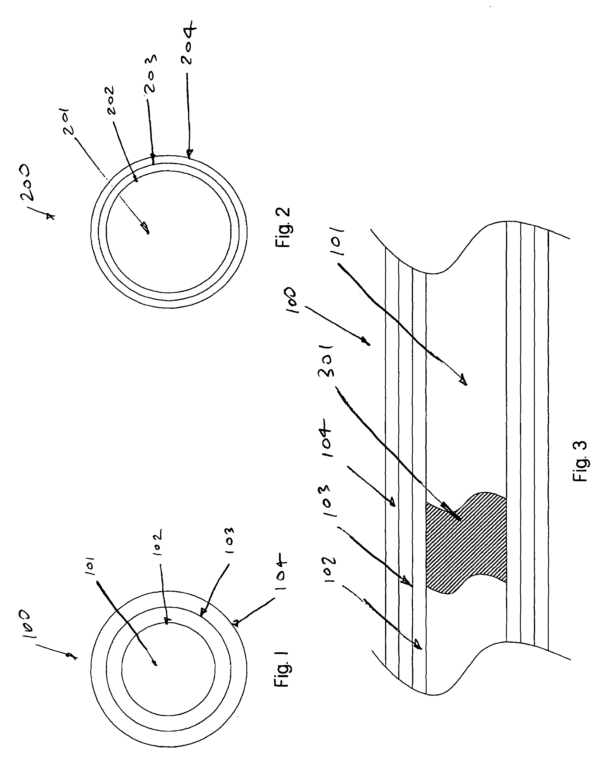 Device and method for vascular re-entry