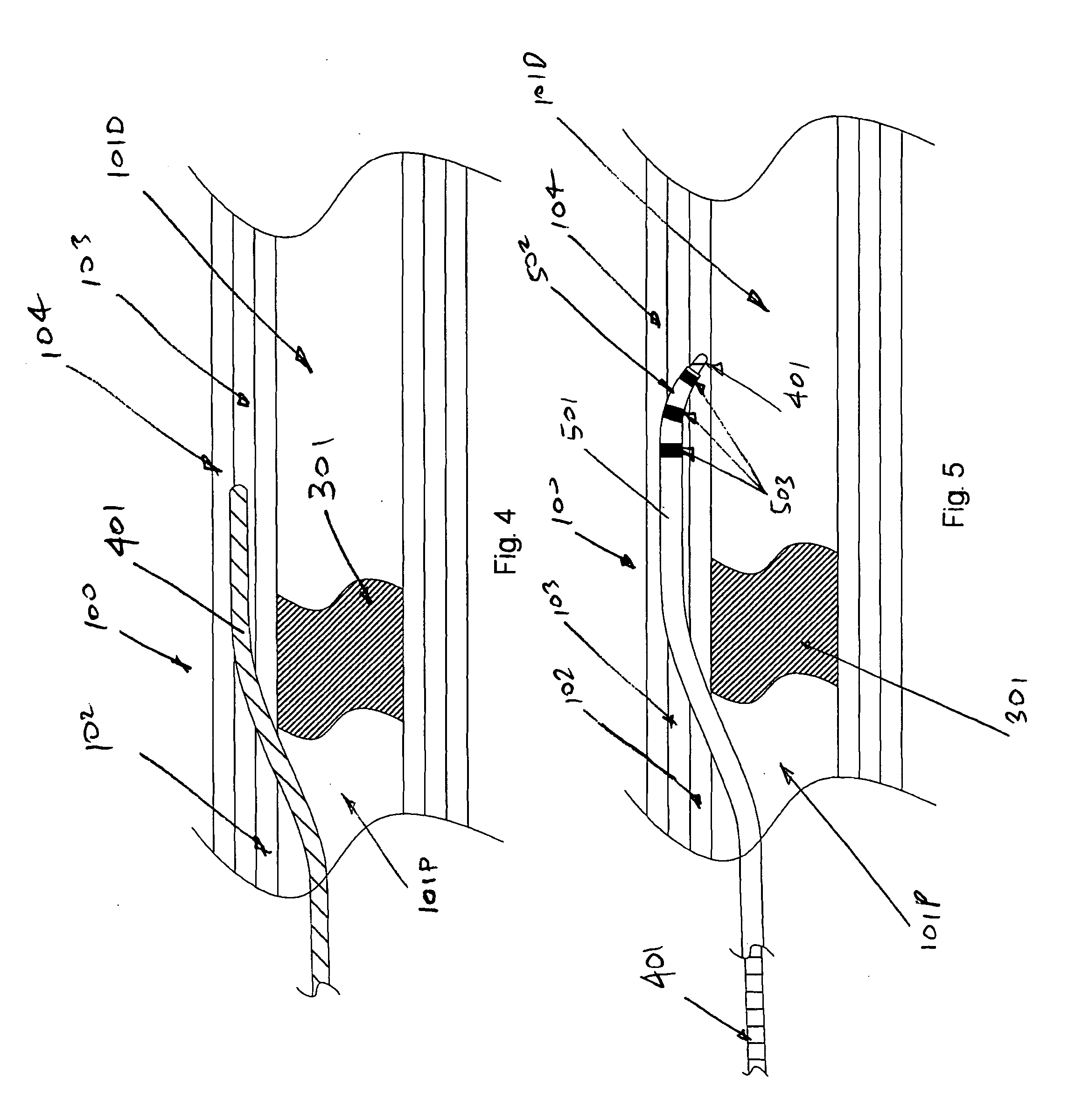 Device and method for vascular re-entry