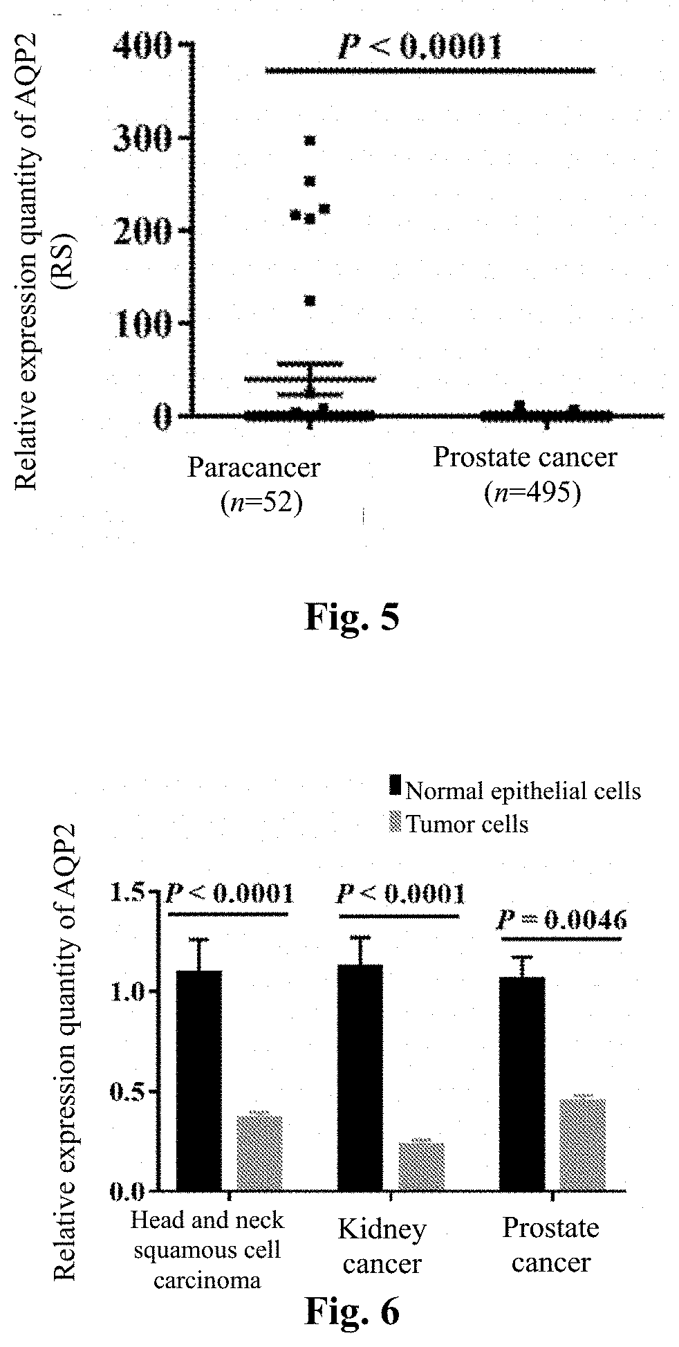 Tumor marker aquaporin 2 protein and application thereof