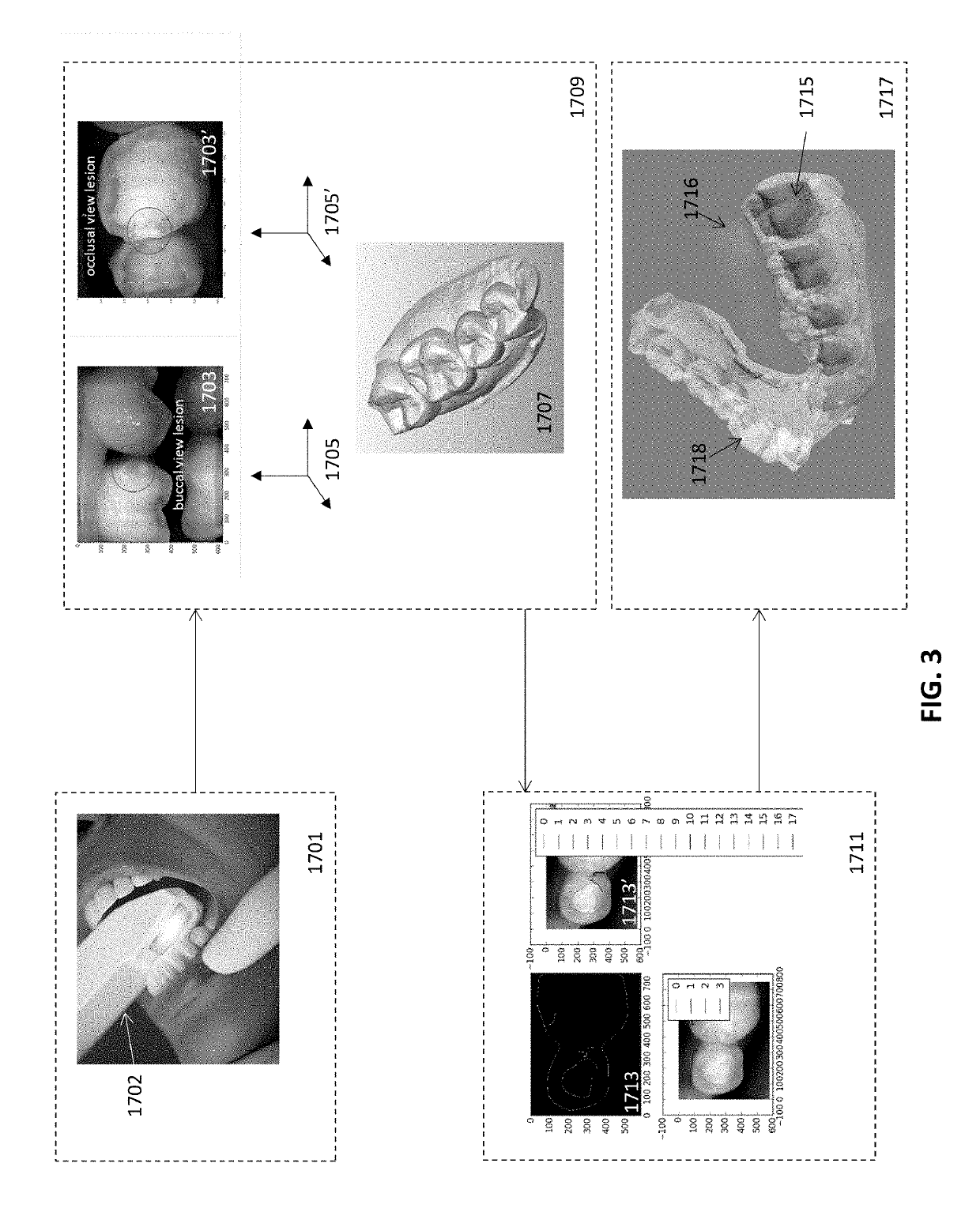 Diagnostic intraoral scanning