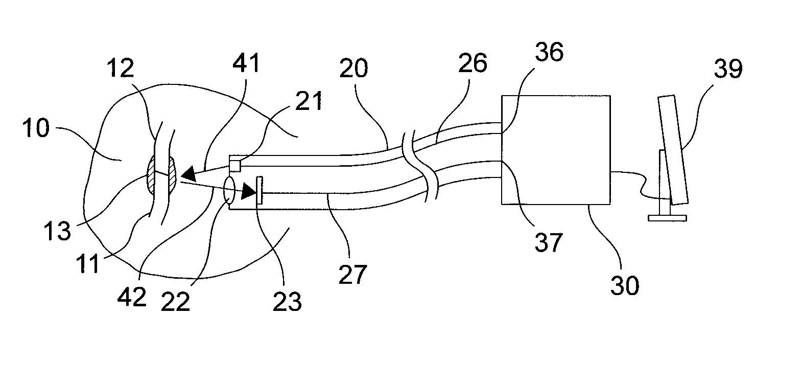 Method and solder for form-fitted joining of two surfaces