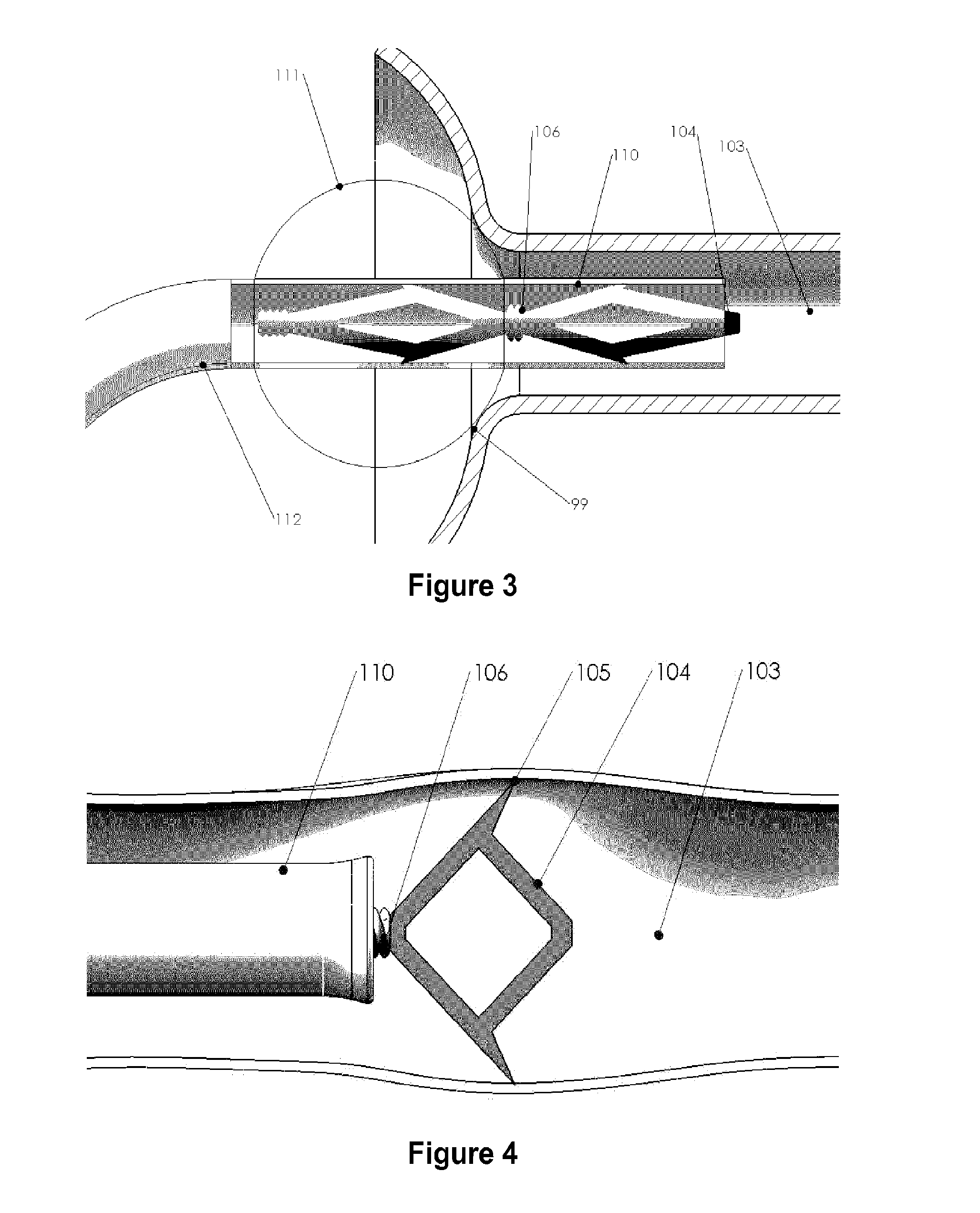 Methods and apparatus for occlusion of body lumens