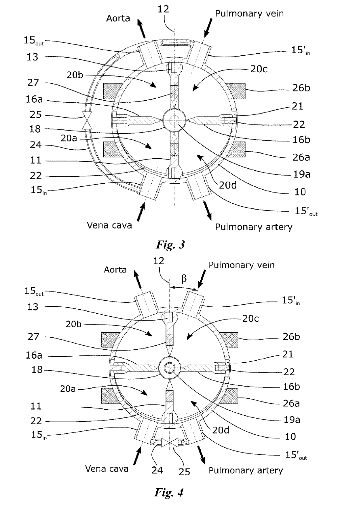 Artificial heart and its drive unit