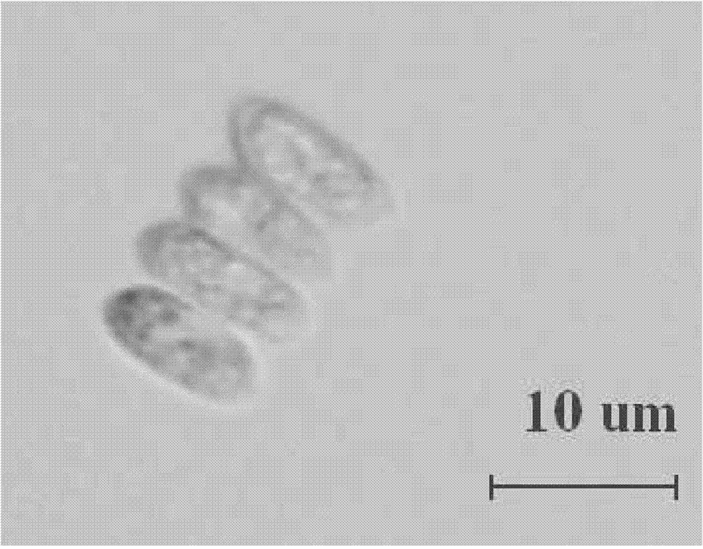 Scenedesmus obliquus capable of synchronously processing municipal sewage and accumulating grease