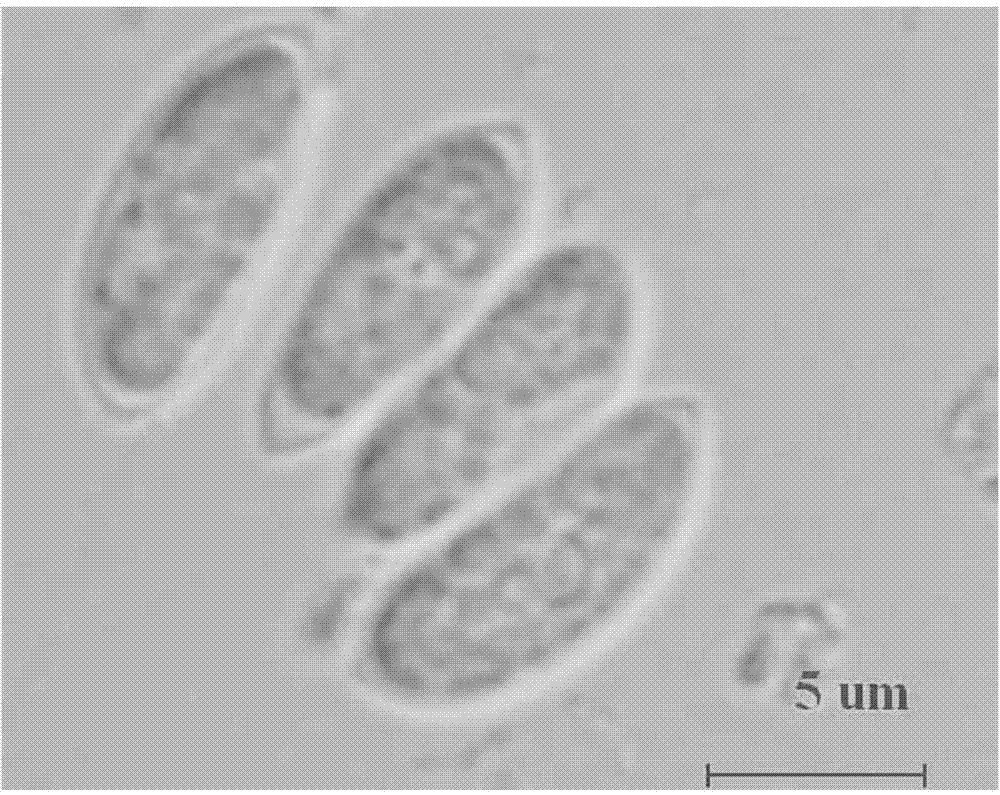 Scenedesmus obliquus capable of synchronously processing municipal sewage and accumulating grease