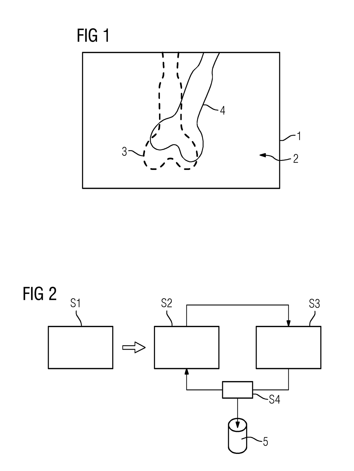 2D/3D registration