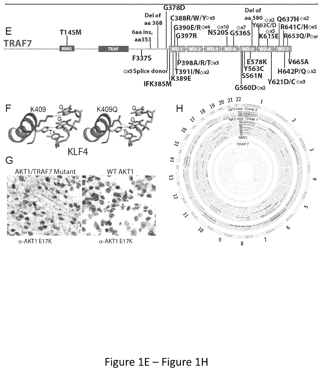 Compositions and methods for diagnosing and treating meningioma