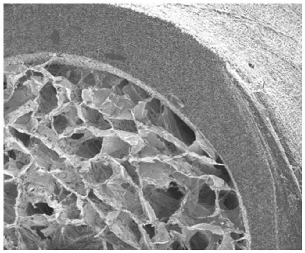 A kind of artificial nerve graft and its preparation method