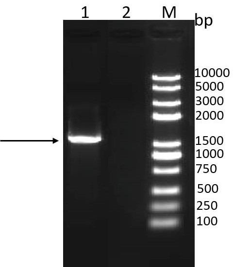 Mycoplasma hyopneumoniae genetic engineering subunit vaccine as well as preparation method and application thereof