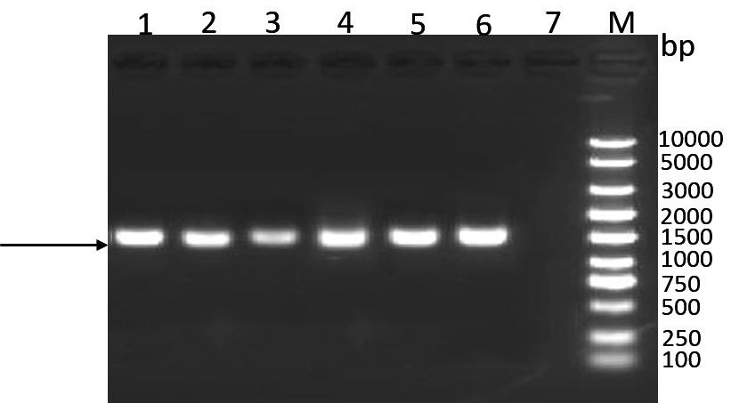 Mycoplasma hyopneumoniae genetic engineering subunit vaccine as well as preparation method and application thereof