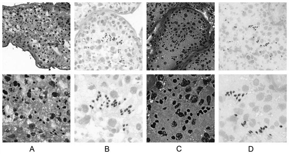 Application of Shorr staining reagent and staining method