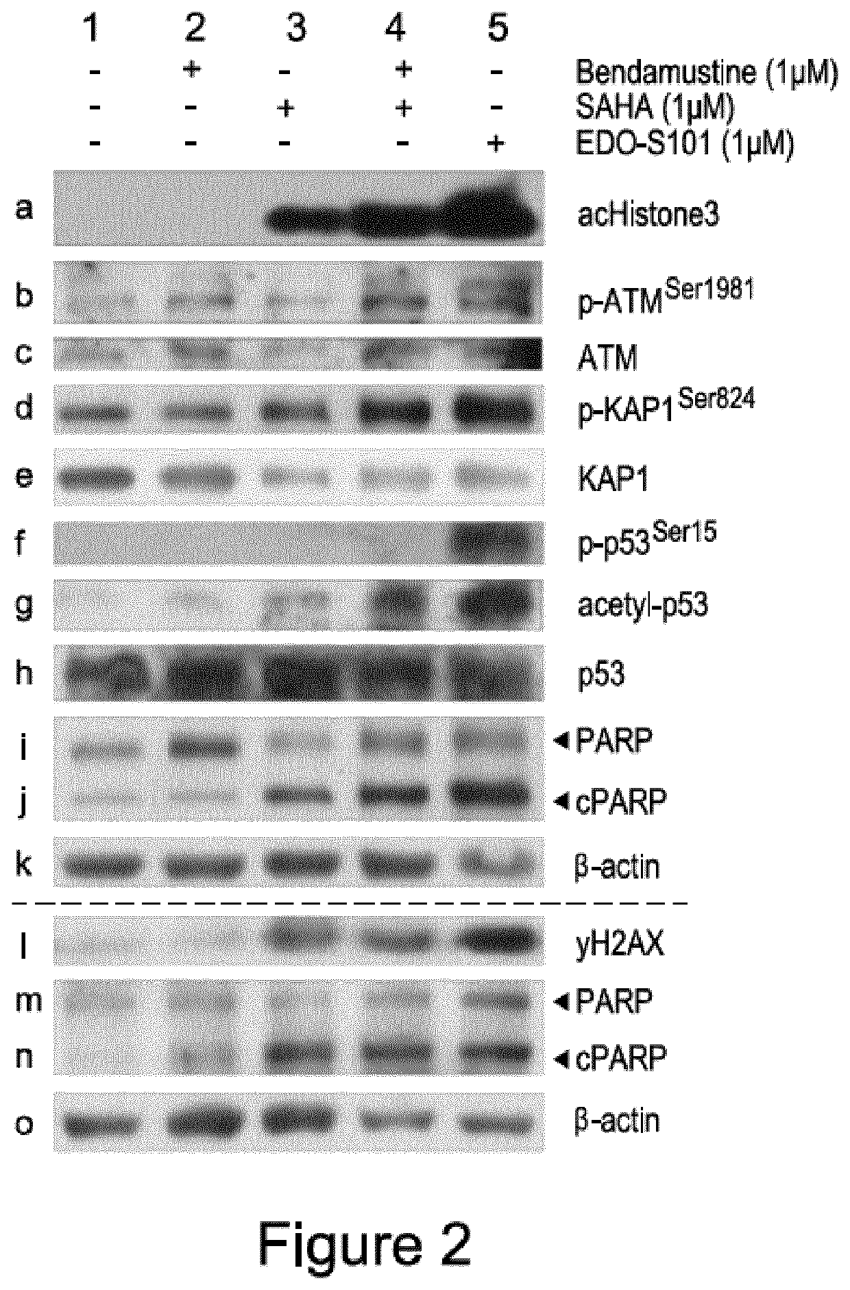 Tinostamustine for use in the treatment of t-cell prolymphocytic leukaemia