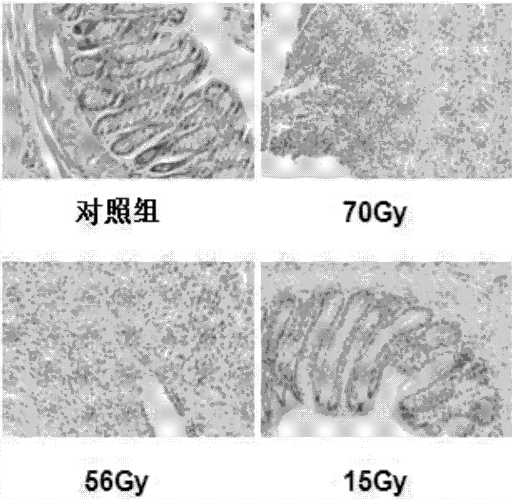 Method for establishing rat delayed radiation proctitis model