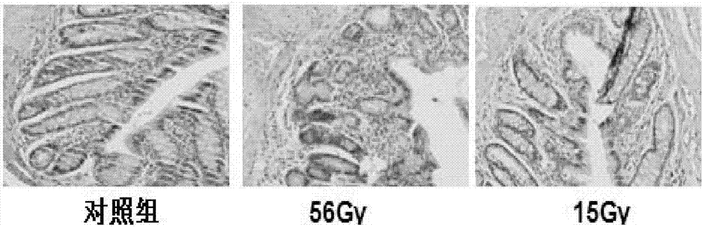 Method for establishing rat delayed radiation proctitis model