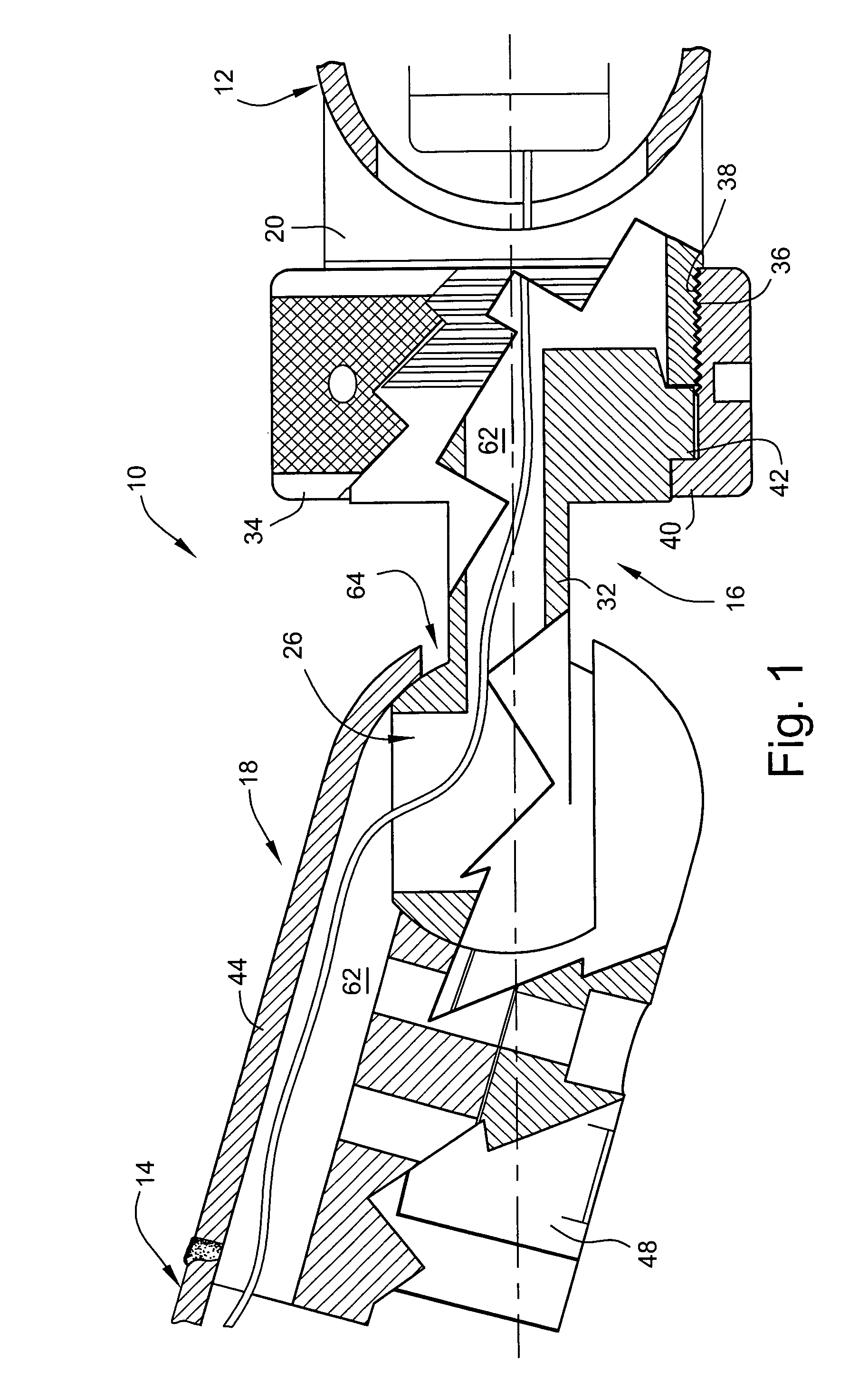 Joint system