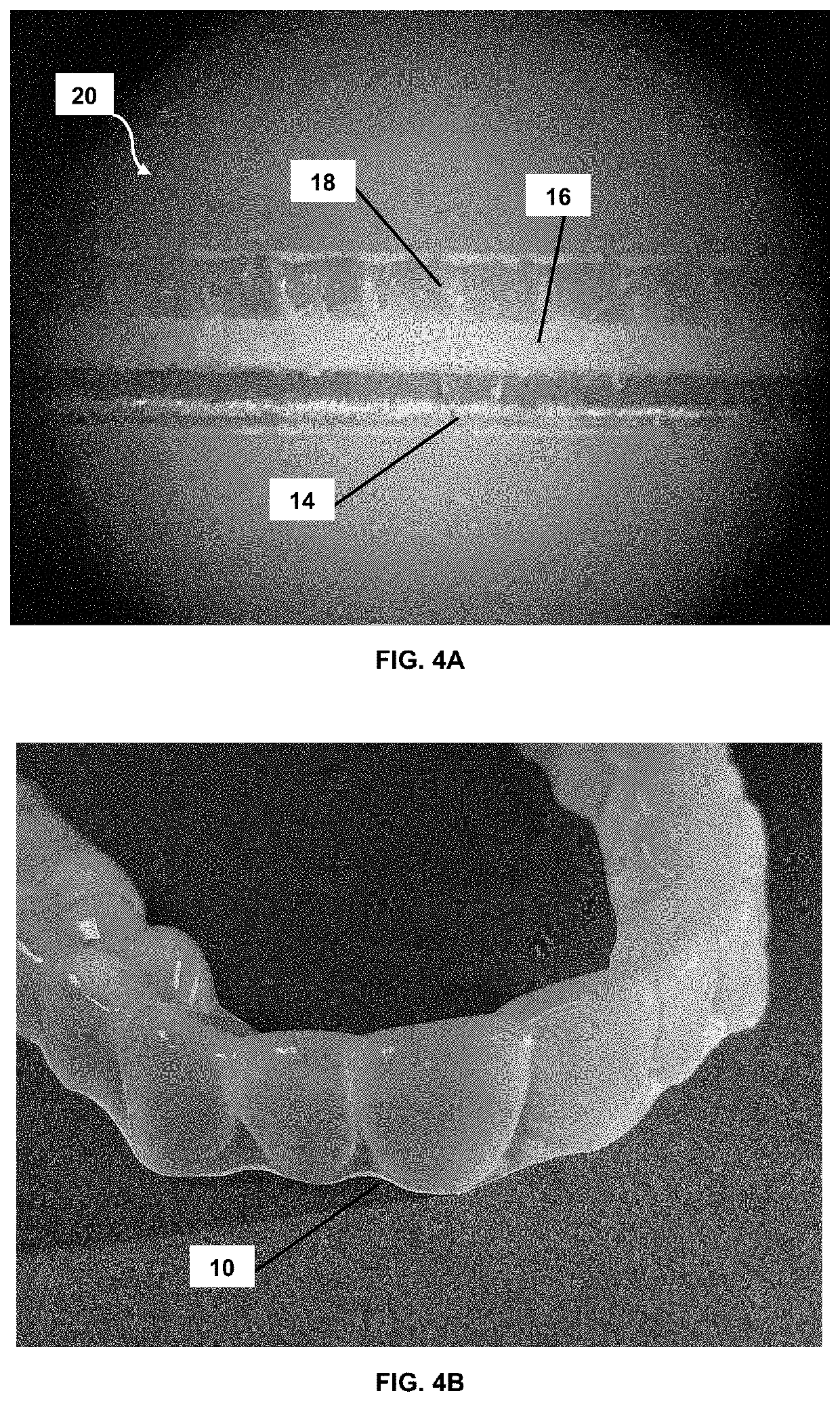 Orthodontic appliances and materials