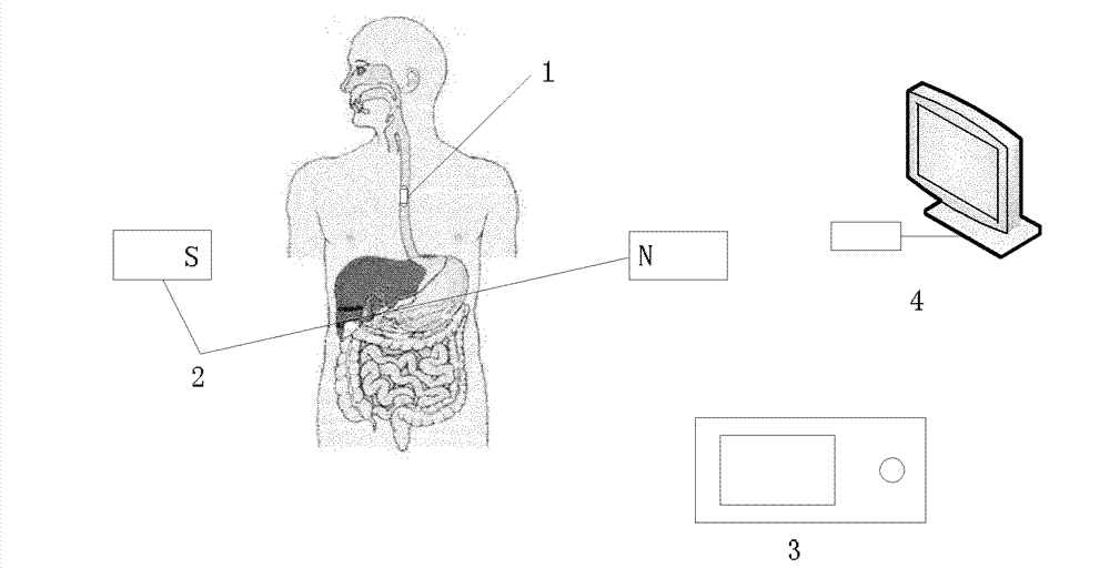 External magnetic control drug release capsule system based on digital image navigation