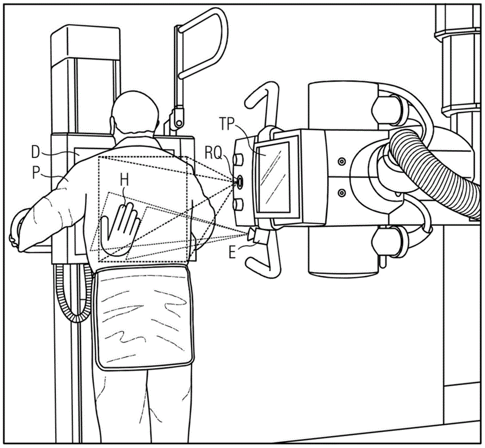 Device and method for the gesture-controlled setting of setting variables on an x-ray source