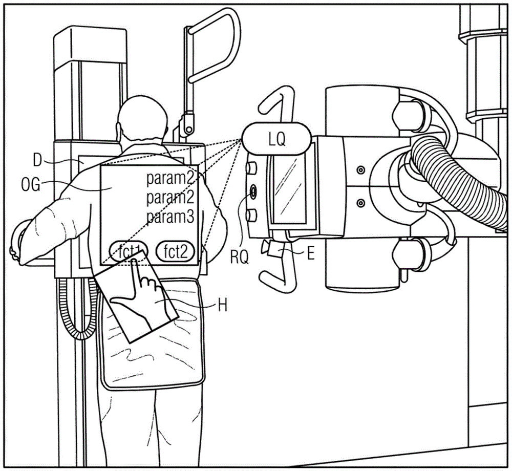 Device and method for the gesture-controlled setting of setting variables on an x-ray source