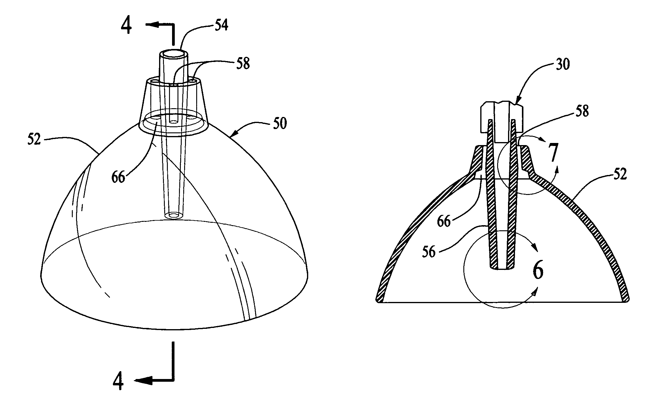 Wound irrigation splashback shield