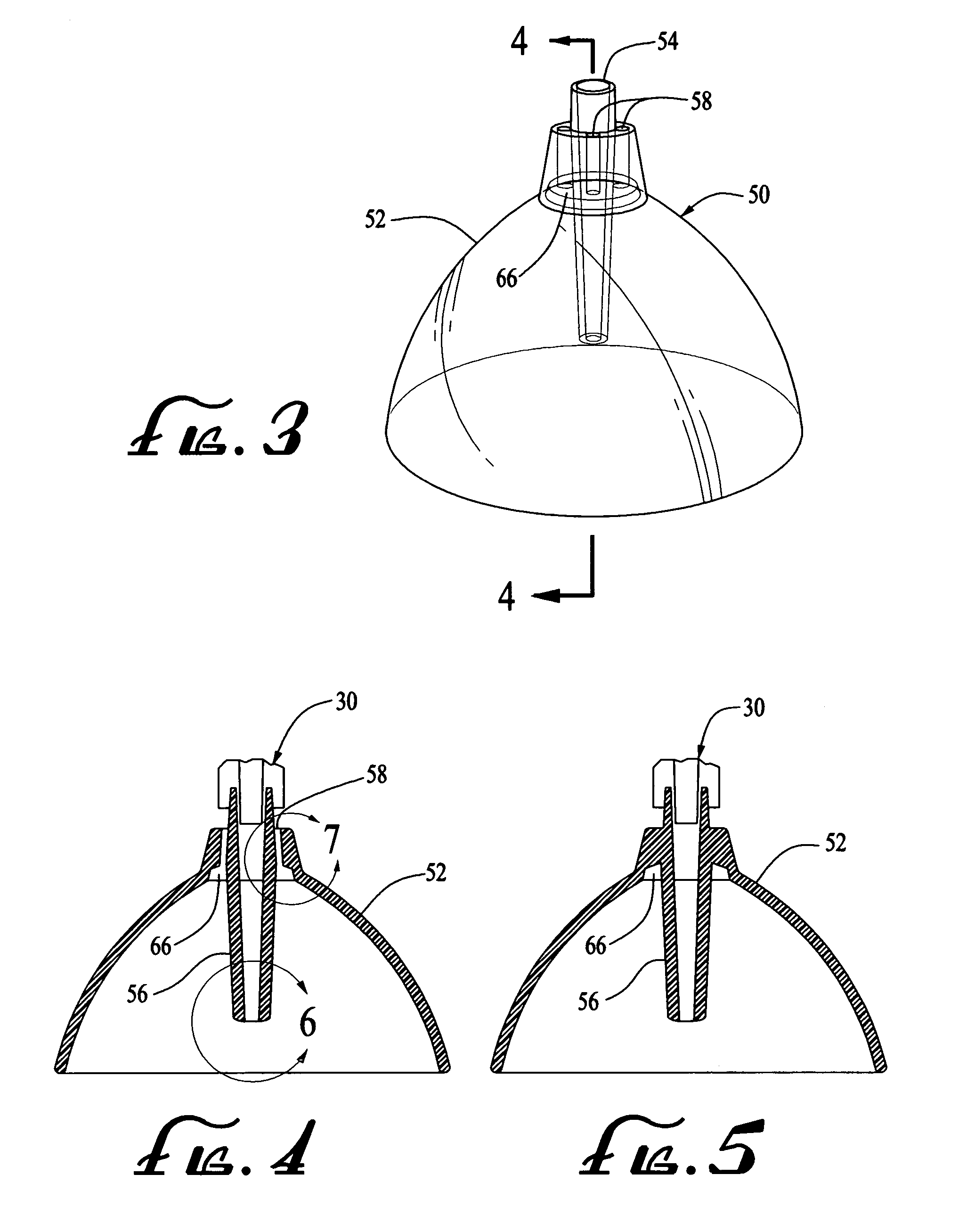 Wound irrigation splashback shield