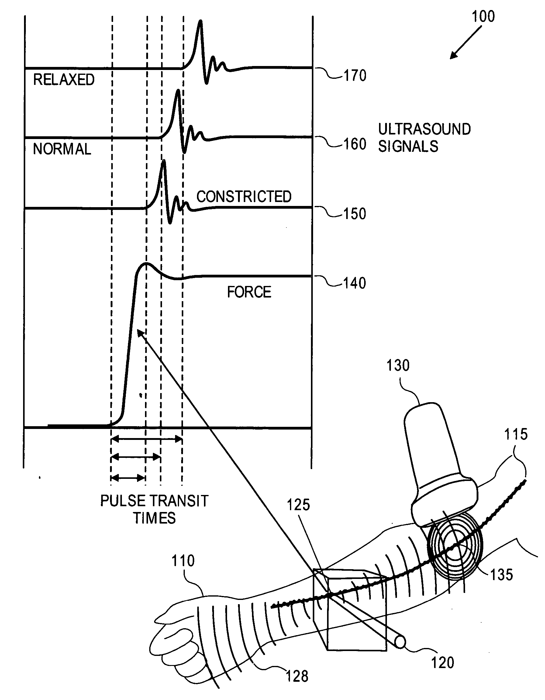 Arterial endothelial function measurement method and apparatus