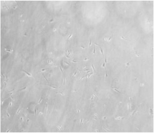 Method for isolating and culturing eyebag adipose-derived stem cell in vitro