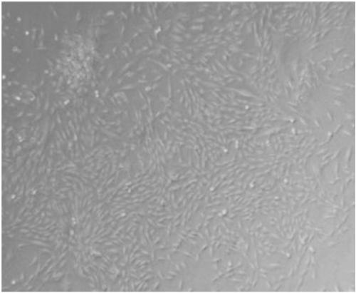 Method for isolating and culturing eyebag adipose-derived stem cell in vitro