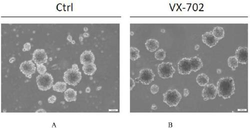 Method for promoting proliferation of neural stem cells