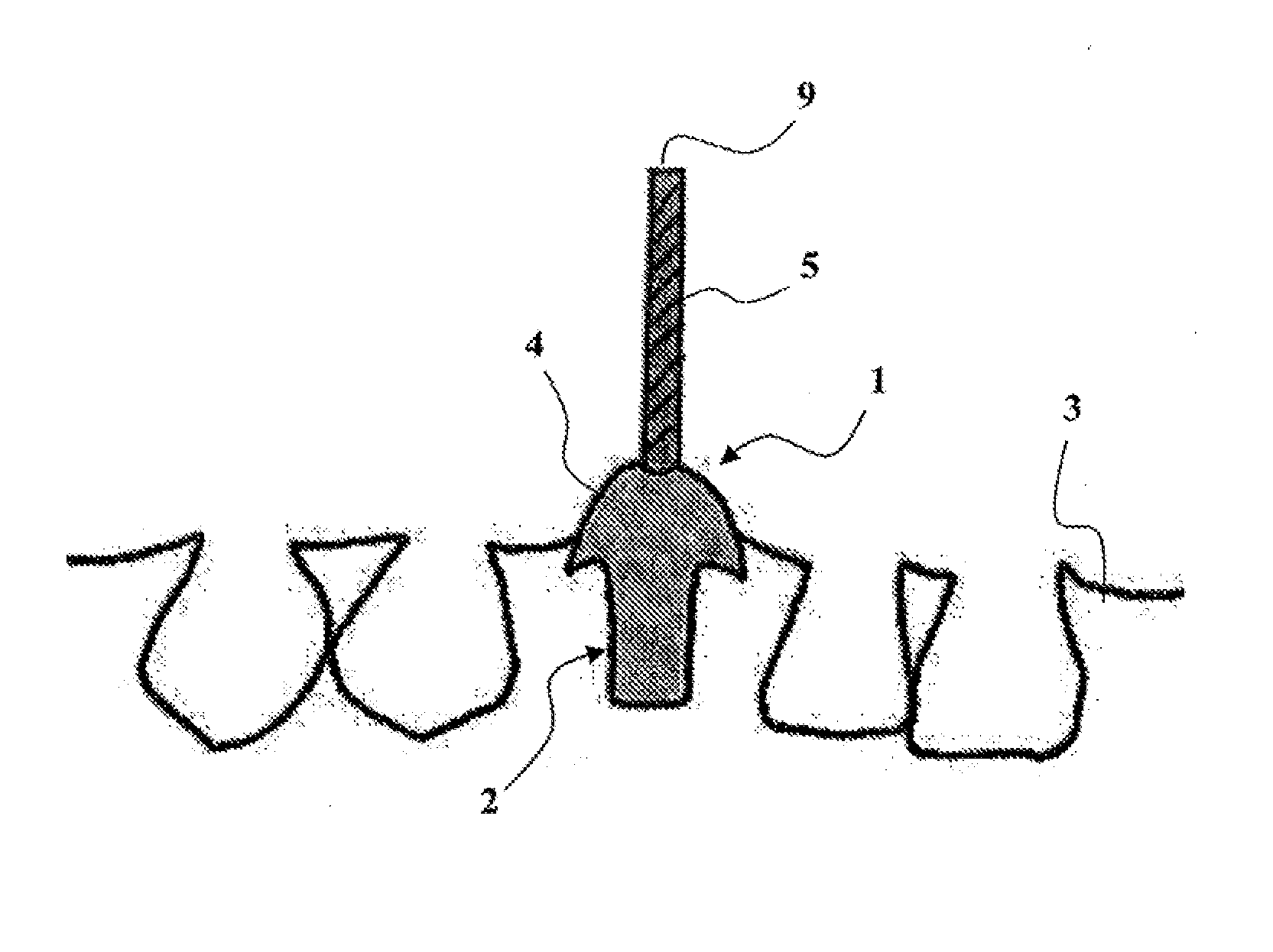 Ceramic Dental Prosthesis, Method and Device For Making Same