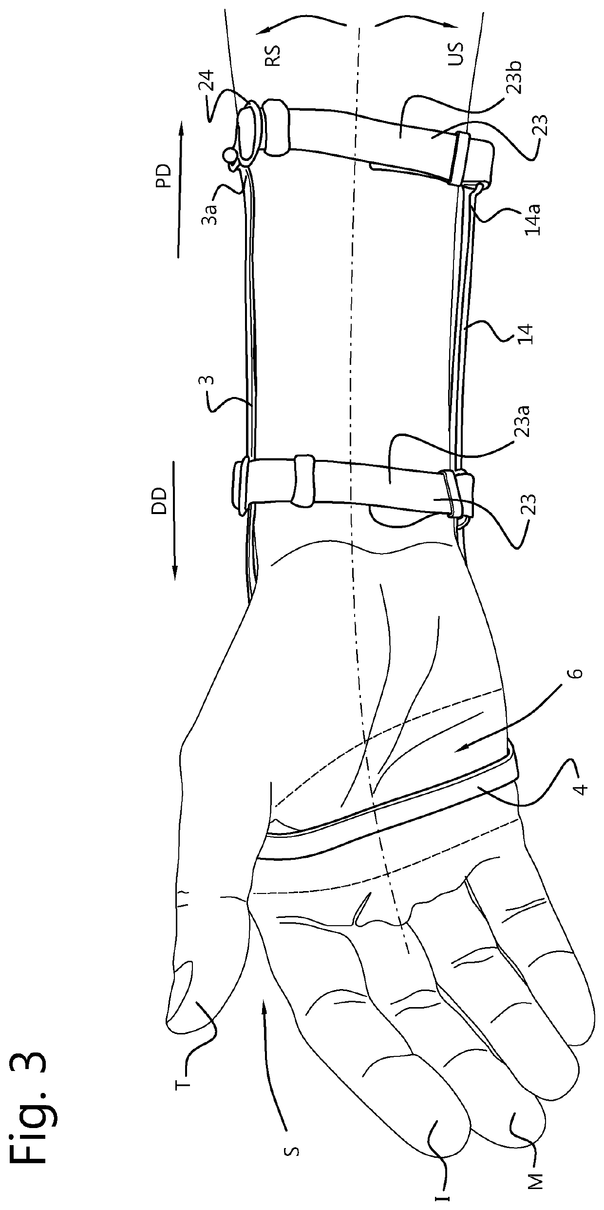 Wrist orthosis