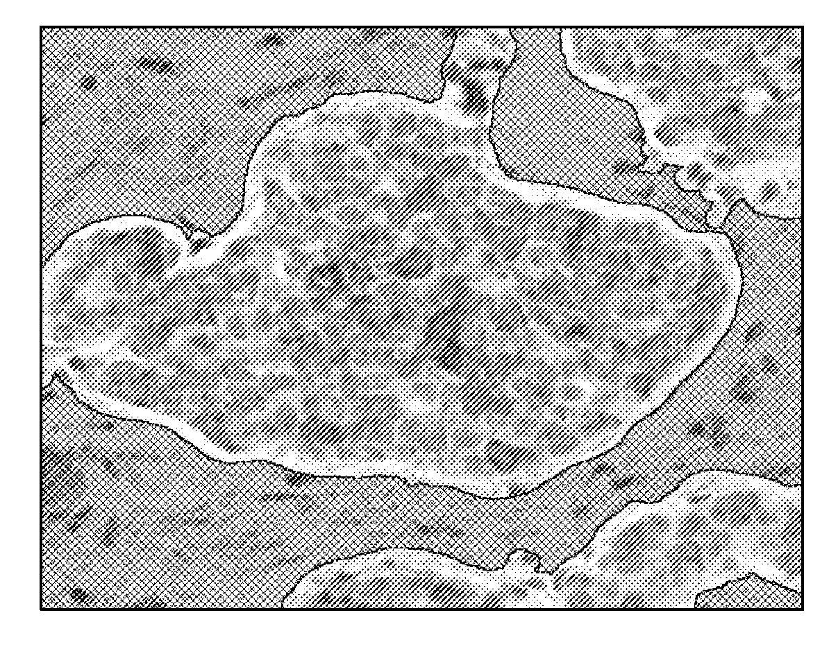 Methods of chromogen separation-based image analysis