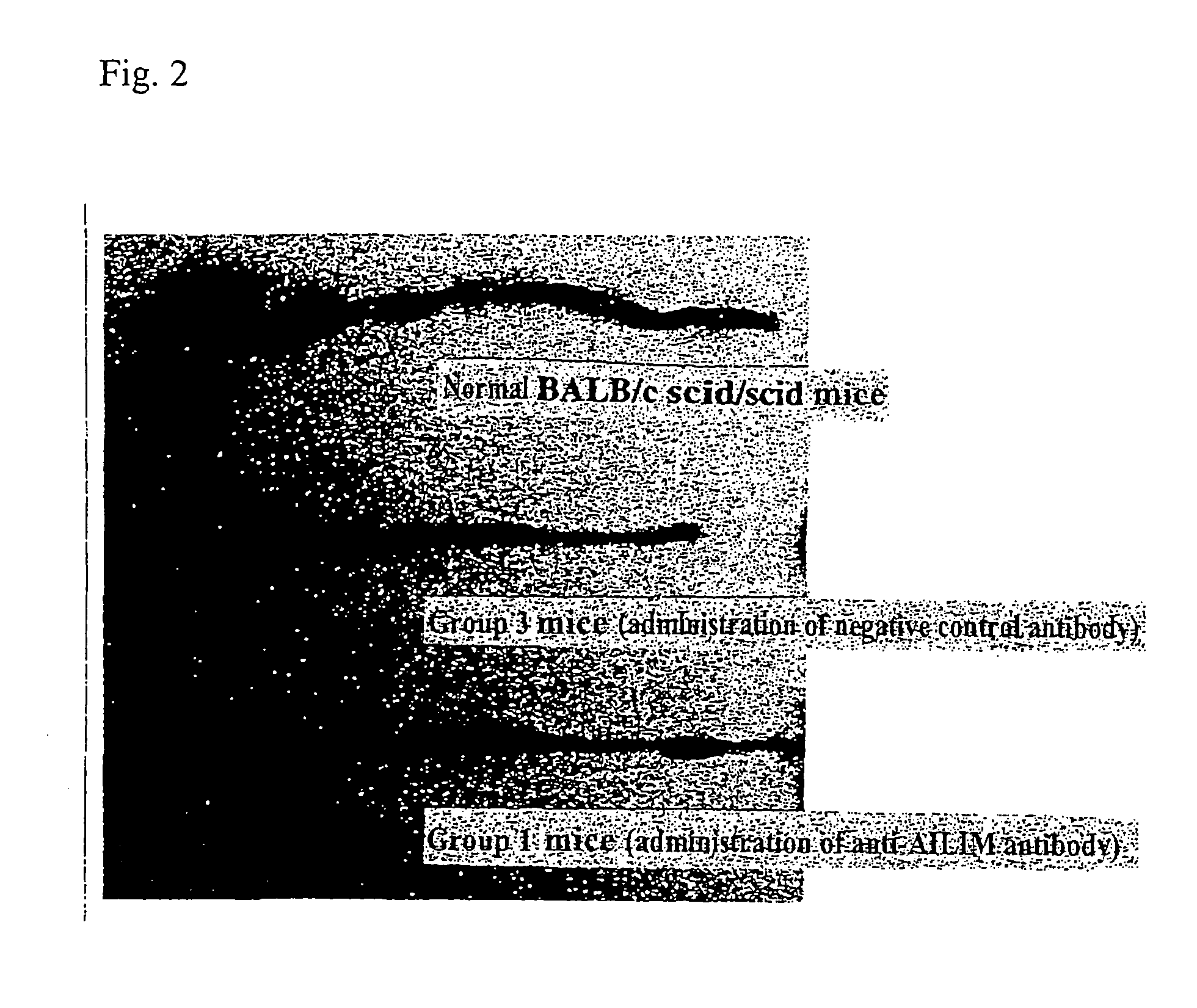 Methods of suppressing or treating an inflammatory bowel disease by administering an antibody or portion thereof that binds to AILIM