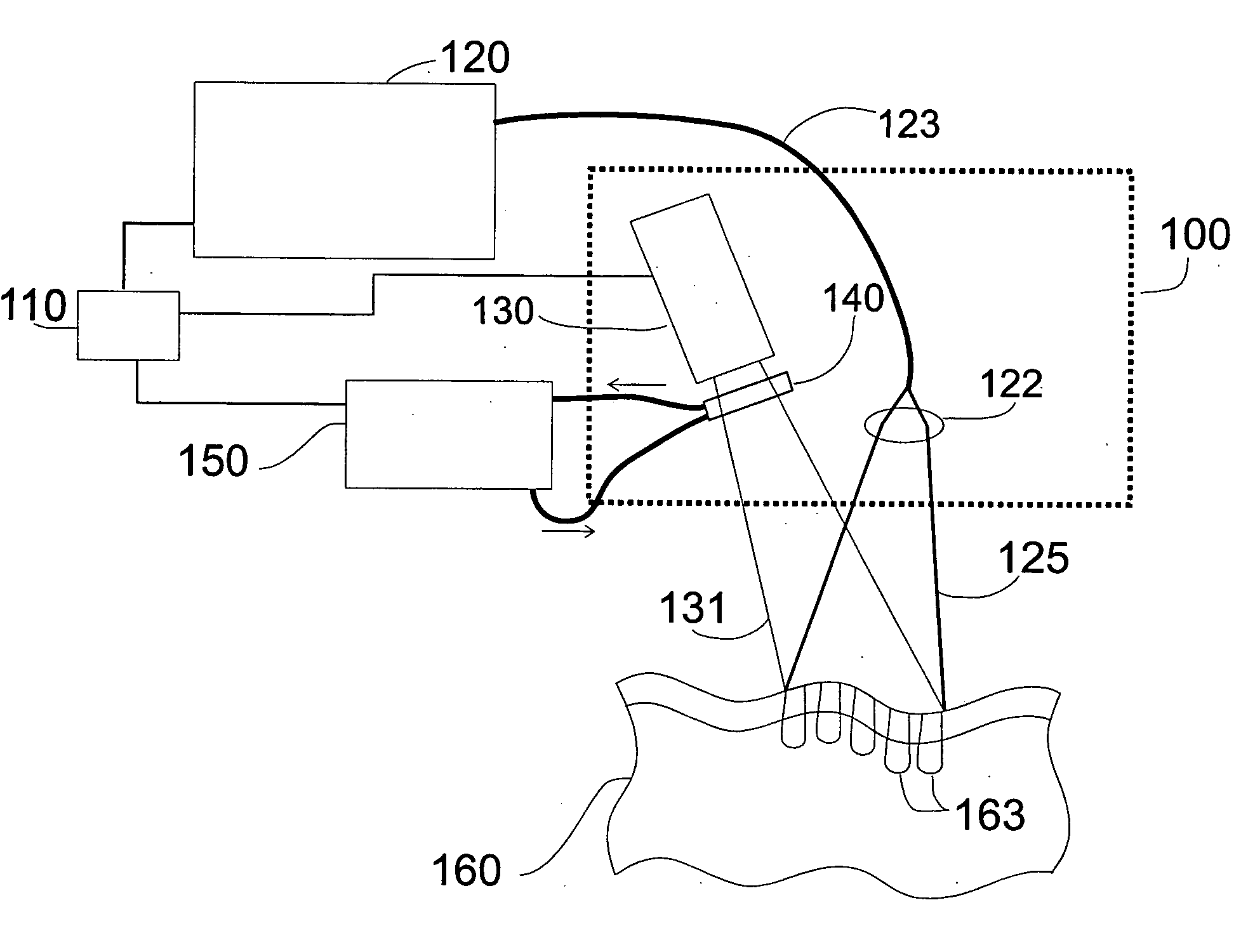 Patterned thermal treatment using patterned cryogen spray and irradiation by light