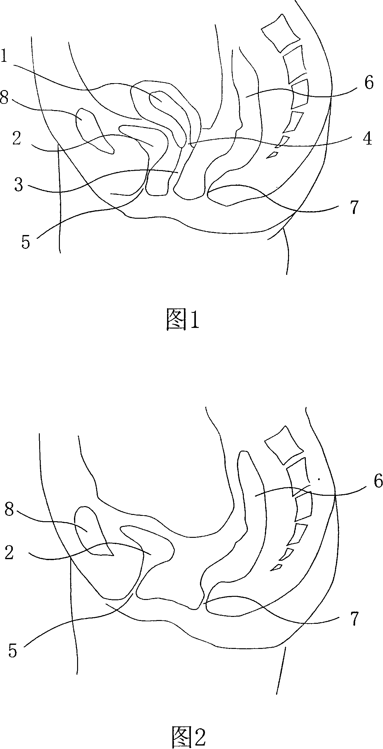 Cunt shaping expanding device