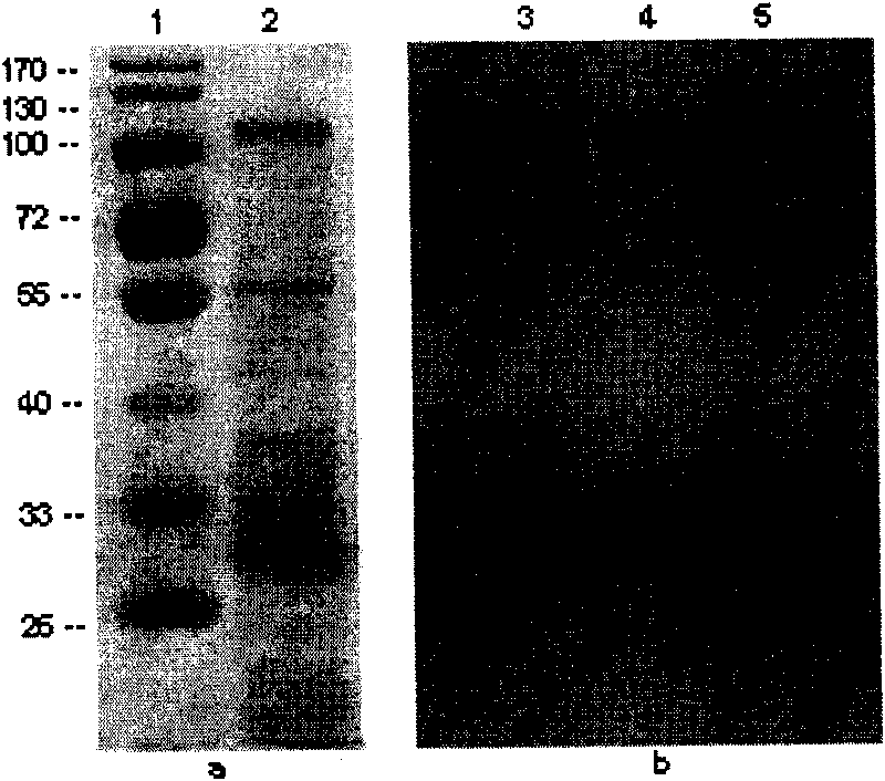 Protein adhered to surface layers of bacteria and application thereof