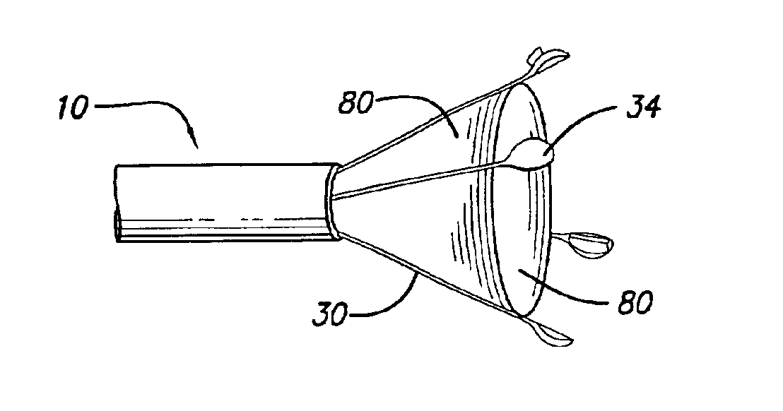 Expandable vein ligator catheter and method of use