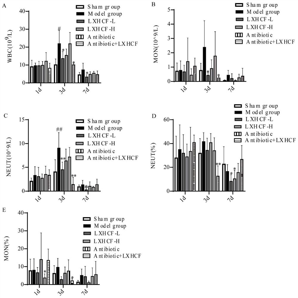 Traditional Chinese medicine composition for treating systemic inflammatory response after cardiac surgery