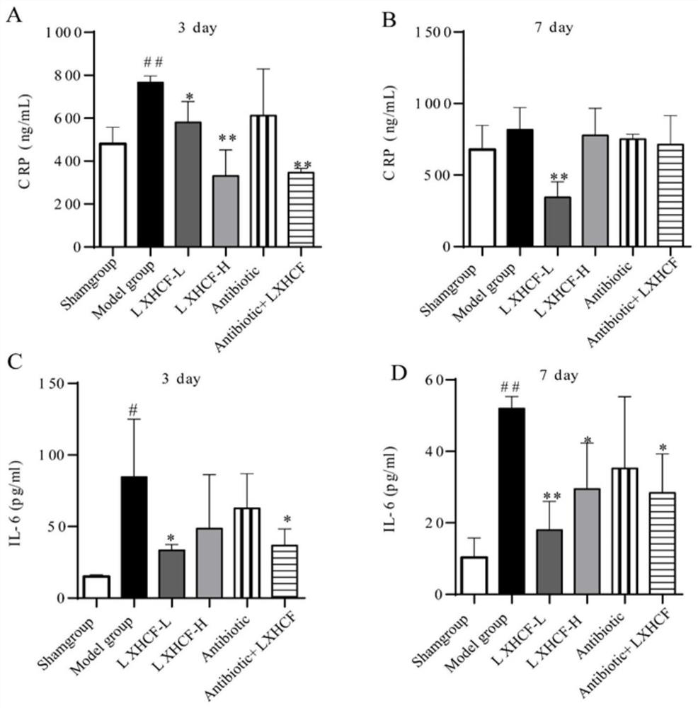 Traditional Chinese medicine composition for treating systemic inflammatory response after cardiac surgery