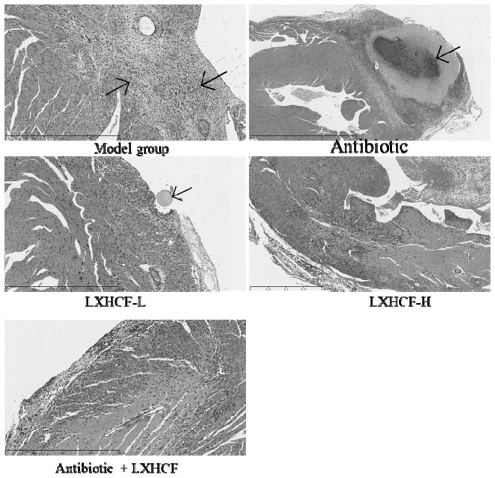 Traditional Chinese medicine composition for treating systemic inflammatory response after cardiac surgery