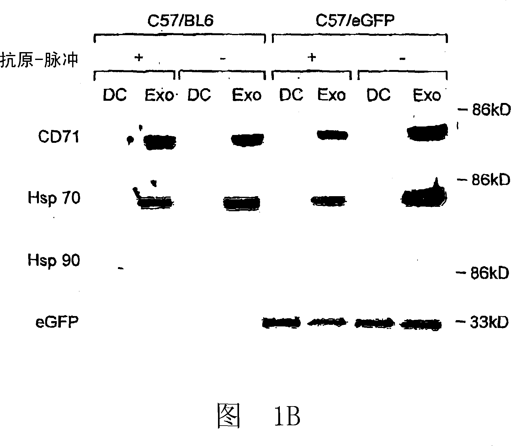 Immunosuppressive exosomes