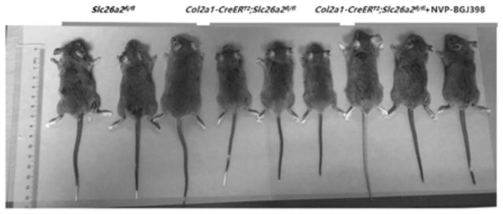 Application of NVP-BGJ398 in preparation of medicine for treating rMED