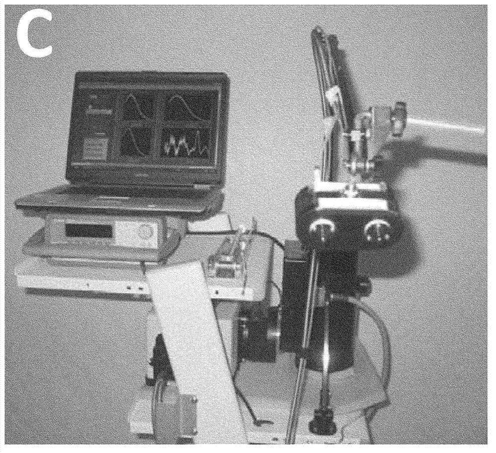 Apparatus and methods for characterization of lung tissue by Raman spectroscopy