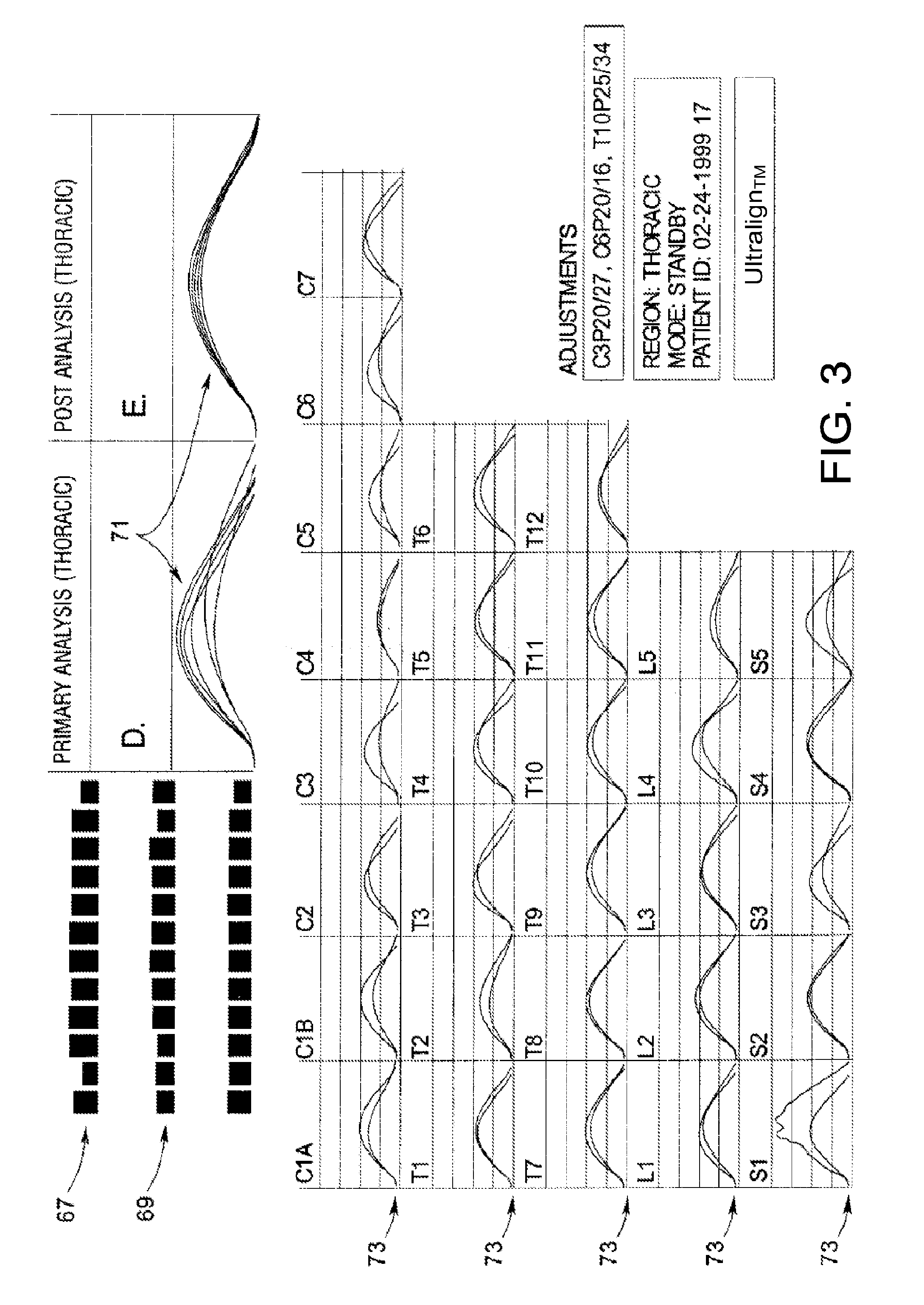 System and method for treating soft tissue with force impulse and electrical stimulation