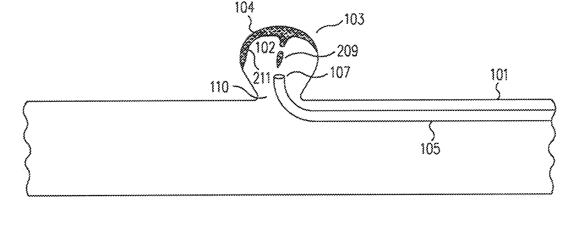 Method and apparatus for aneurismal treatment